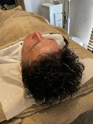 メンズ 美容鍼灸サロンulu所属・美容鍼灸サロン ulu【博多祇園】のエステ・リラクイメージ