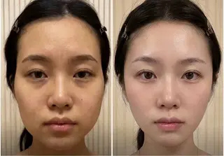 マツエク・マツパ aliaハイフ&水光ジェットサロン所属・aliaハーブ水光店 エステティシャン募集のエステ・リラクイメージ