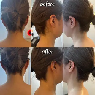 うなじ脱毛/美肌脱毛 LABELのエステ・リラクイメージ