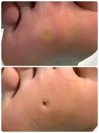 東京巻き爪アカデミー所属・東京巻き爪 アカデミーのエステ・リラクイメージ