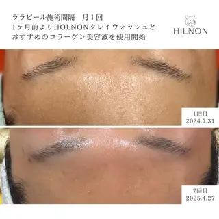 RUPO THE MAINTENANCE新潟店【ローマピンク公式認定店/ララピール正規店/骨格小顔】所属・オーナー Nanjoのエステ・リラクイメージ