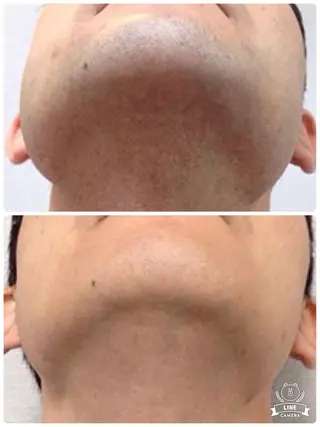 メンズ キッズ 脱毛・美肌サロン Epi Houseのエステ・リラクイメージ