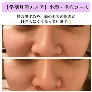 Bellesthe （ベルエステ）のエステ・リラクイメージ