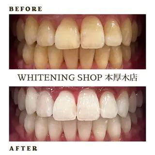 メンズ ホワイトニング ショップ本厚木のその他イメージ