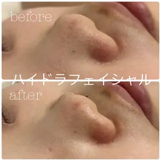 フェイシャルサロン CHIARA 荒田のエステ・リラクイメージ