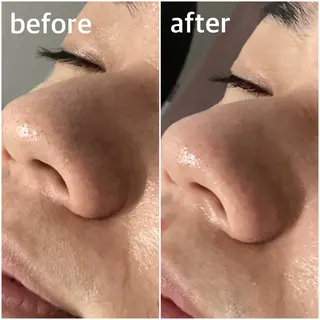 Pullulant EstheKyotoのエステ・リラクイメージ