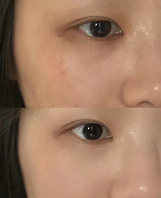 マツエク・マツパ 愛維美水光美肌専門店所属・愛維美水光美肌専門店 メンズレディースokのエステ・リラクイメージ