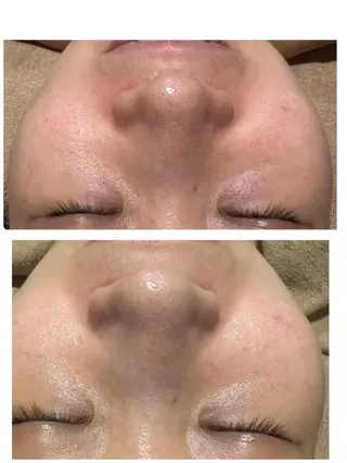 堀尾 あけみのエステ・リラクイメージ