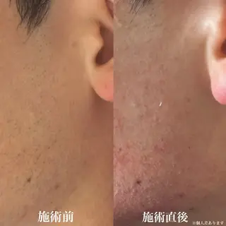 メンズ muumo所属・muumo まりののエステ・リラクイメージ