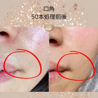 中庄駅前エステ BRILLAR小豆のヘアスタイル