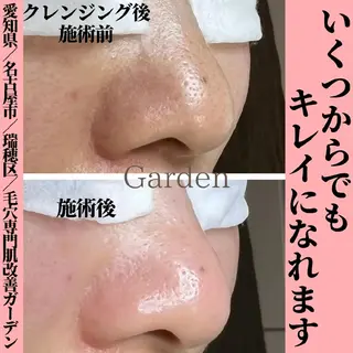 プライベートサロン Gardenのエステ・リラクイメージ