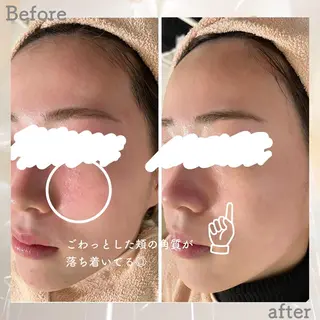 ニキビ&跡改善サロン オーナー光木のエステ・リラクイメージ