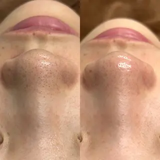 re.make所属・小顔美肌💖痩身☃️ ユキナ🤍のエステ・リラクイメージ