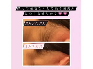 美肌脱毛専門サロン Dione栄店のエステ・リラクイメージ