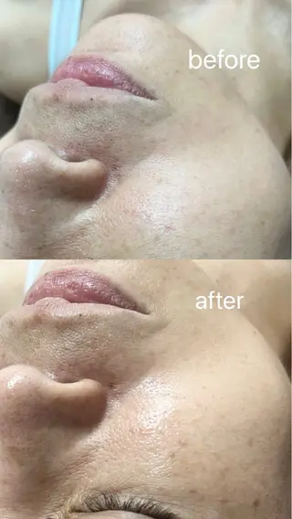 smile nail スマイルネイルのその他イメージ