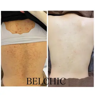 BeSkin藤沢店所属・ニキビ/肌質改善 BeSkin 藤沢店のエステ・リラクイメージ