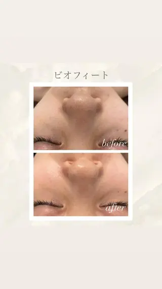 🦋美肌サロン. maho🦋のエステ・リラクイメージ