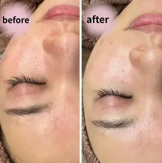 からだ びよりのエステ・リラクイメージ