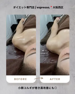 espresso,所属・《痩身、小顔専門店》 エスプレッソのエステ・リラクイメージ