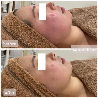 salon ditto所属・mio (小顔・ヘッドスパ)のエステ・リラクイメージ