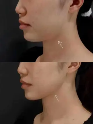 ネイル aliaハイフ&水光ジェットサロン所属・aliaハーブ水光店 エステティシャン募集のエステ・リラクイメージ