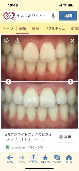 WHITENING ハウスのマツエク・マツパデザイン