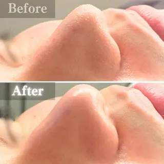 毛穴洗浄特化🫧 オオツカのエステ・リラクイメージ