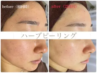 ResetLab 佐藤 風香のエステ・リラクイメージ