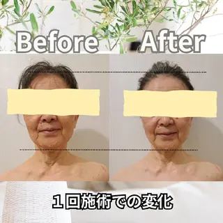 肩首腰コリ小顔サロン ～Kashette～のエステ・リラクイメージ