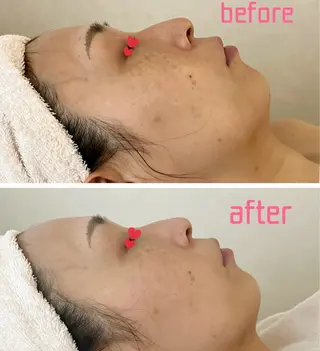 シミ・たるみ・毛穴ケア専門サロン Alluring所属・Alluring 中村のエステ・リラクイメージ