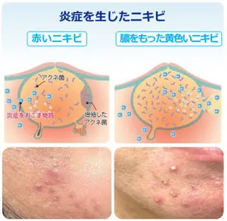 フェイシャル専門 肌質改善/プランスのエステ・リラクイメージ