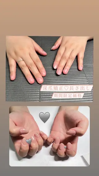 メンズ ネイル 爪ケア/深爪 自爪育成 🐰えむのネイルデザイン