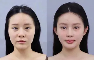 ショート aliaハイフ&水光ジェットサロン所属・aliaハーブ水光店 エステティシャン募集のエステ・リラクイメージ