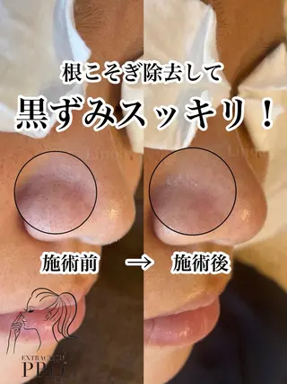 Private salon Linoa所属・プライベートサロン Linoaのマツエク・マツパデザイン