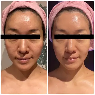 調律エステ /美KISSのその他イメージ