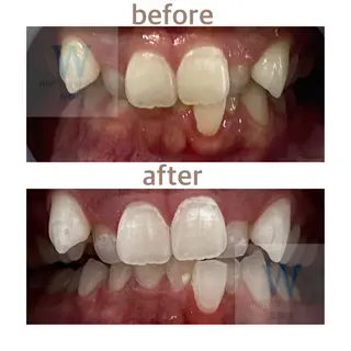 ホワイトニング ショップ船橋２号店のエステ・リラクイメージ