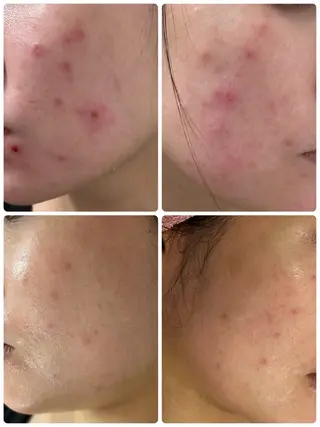 CEサロンbelle mona所属・CEサロン belle monaのエステ・リラクイメージ