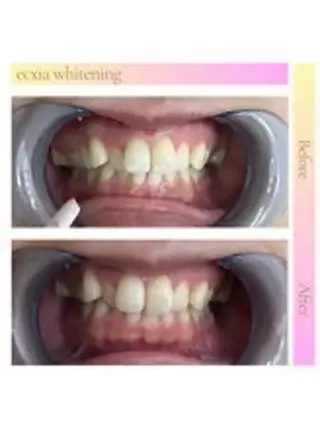 セルフホワイトニング エクシア西宮北口店所属・セルフホワイトニング エクシア西宮北口店のその他イメージ