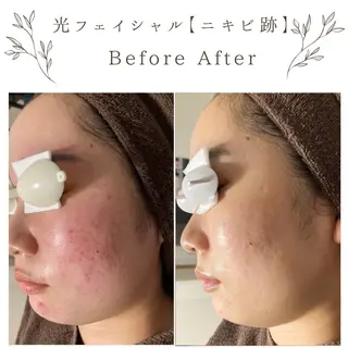 な ぎのエステ・リラクイメージ