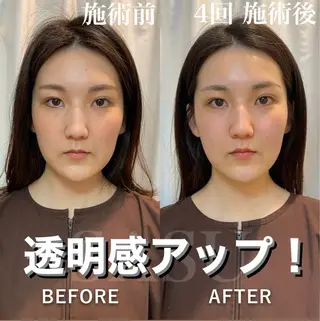 鍼灸×ハーブピーリングサロンSASU所属・石井 稚乃のその他イメージ