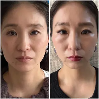 【敏感肌管理×小顔サロン】Belle orchid所属・敏感肌×小顔サロン 玲央奈のエステ・リラクイメージ