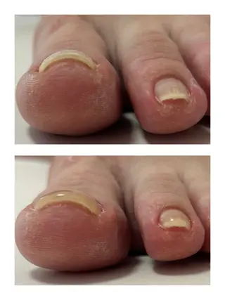 ネイル なが さきのネイルデザイン