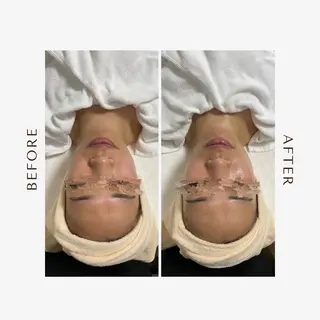 東海エリア1位受賞 長江香保のエステ・リラクイメージ