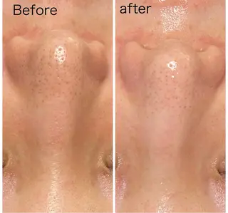 エイジングケア専門 Ponolaのエステ・リラクイメージ