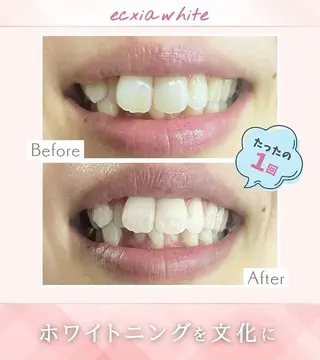 エクシアホワイトニング草津店所属・nanami -ホワイトニングのその他イメージ