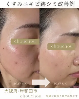 chouchou minaのエステ・リラクイメージ