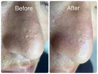 salon HATOのエステ・リラクイメージ