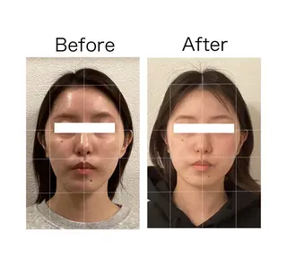 小顔サロンSharp …腸調整よもぎ蒸しのエステ・リラクイメージ