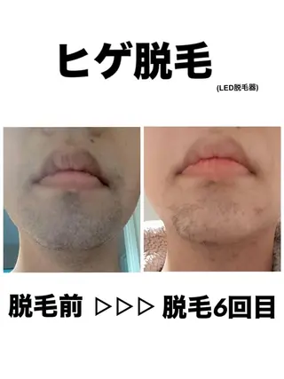 脱毛・眉毛・フェイス サロンN久留米店の眉毛・アイブロウイメージ