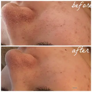 メンズ メナード岐阜市茜部 杉浦のエステ・リラクイメージ